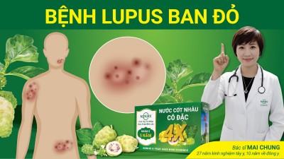 Bệnh LUPUS BAN ĐỎ và phản ứng của Noni4x có thể xảy ra