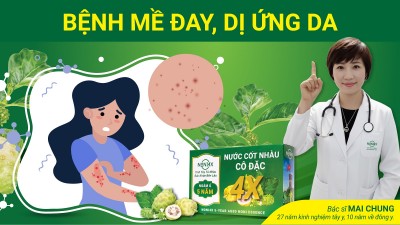 MỀ ĐAY, DỊ ỨNG DA và phản ứng của Noni4x có thể xảy ra